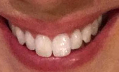 Smiling mouth with white, even teeth.